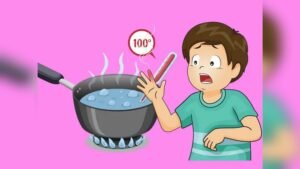 Best Treatment for Boiling Water Burns: Fast Relief Tips